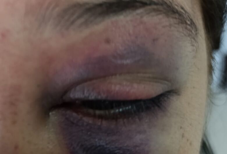 Mulher é brutalmente espancada pelo companheiro em Dourados